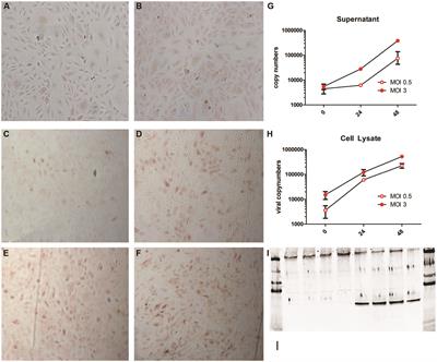 Effect of Puumala hantavirus infection on human umbilical vein endothelial cell hemostatic function: platelet interactions, increased tissue factor expression and fibrinolysis regulator release